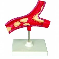 Arterijos modelis
